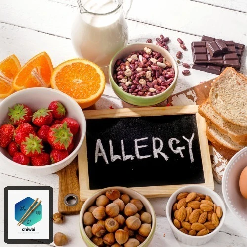 Allergenkennzeichnung Vorlagen: Kostenlos herunterladen — Infografik